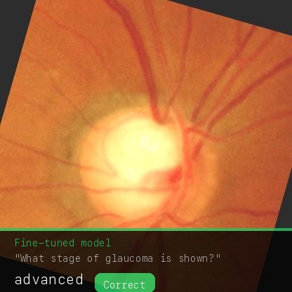 Fine-tuned model answers advanced, correct