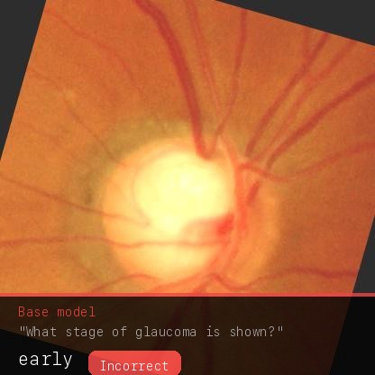 Base model answers early, incorrect